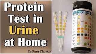 Test Protein in Urine at Home [upl. by Ylahtan]