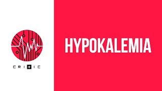 Hypokalemia  an easy workup [upl. by Ytissac]