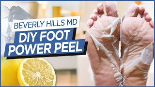 How To Make DIY Foot quotPower Peelquot Easy to make  Beverly Hills MD Beauty Tips [upl. by Karylin314]