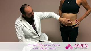 Liposuction Contour Irregularity  Stubborn Lipo Lumps and Bumps [upl. by Annayad]