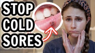 Ways to get immediate relief from cold sore throat amp fever  Dr Gayatri S Pandit [upl. by Ataynek766]