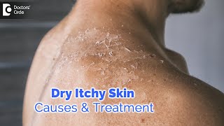 How To Care For Dry Flaky amp Dehydrated Skin  DIY Face Masks amp AtHome Remedies [upl. by Seko]