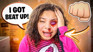 I GOT BEAT UP PRANK ON BOYFRIEND CUTE REACTION [upl. by Eiramyllek]