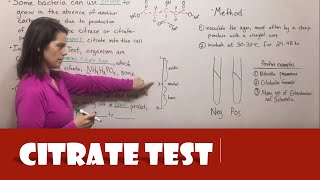 Citrate Test [upl. by Elem]