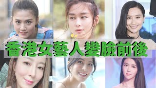 23位香港女星整容前後 原來她她她也有變臉？成功vs失敗案例 [upl. by Belloir74]