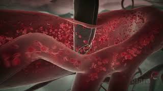 Malaria 3D Animation Shows How the Infection Spreads in the Body [upl. by Detta477]