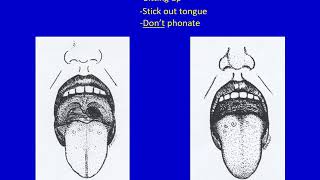 Preoperative Evaluation  Dr Hessel [upl. by Arodal]