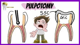 PEDIATRIC DENTISTRY  PULPOTOMY  Types Indications Procedure [upl. by Zanas666]