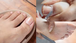 Relaxing DIY ASMR Pedicure Callus Feet  Water Sounds [upl. by Eylrac903]