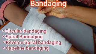 Bandaging and its Types  Capeline bandaging Circular bandaging Spiral bandaging Reverse Spiral [upl. by Shakti478]