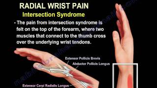 Wrist Paincauses and treatmentPart 2  Everything You Need To Know  Dr Nabil Ebraheim [upl. by Norvell477]