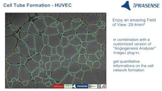 Cell Tube Formation  HUVEC on Matrigel [upl. by Kerwon43]