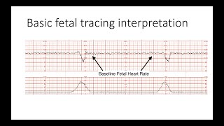 Fetal Circulation in under 5 minutes [upl. by Aztinad]