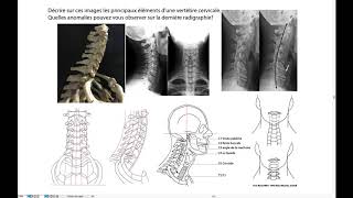 Radiographic Interpretation of Dental Anatomy [upl. by Carney]