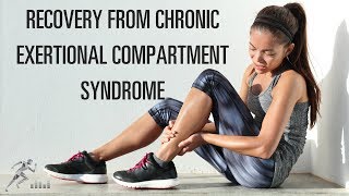 Recovery from chronic exertional compartment syndrome CECS [upl. by Llekcm]