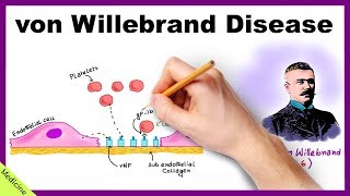 VON WILLEBRAND DISEASE Pathophysiology Clinical Findings Diagnosis Treatment [upl. by Nilya856]