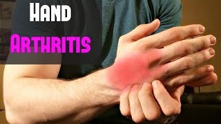 Fast Treatment for Hand Arthritis  Self Massage [upl. by Beker]