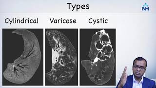 HRCT Temporal bone  Lecture  5   Dr Satish Jain  wwwskullbase360in [upl. by Edette]