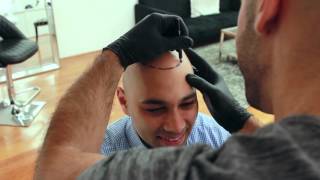 Inside Look Scalp Micropigmentation Treatment  Scalp Micro USA [upl. by Ronoh869]