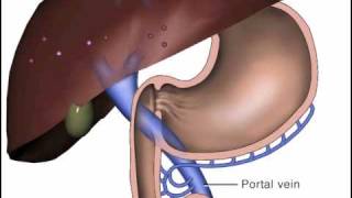 Pharmacology Oral Meds Absorption [upl. by Perrine551]