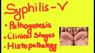 Syphillis Pathogenesis 2 Clinical Stages and Histopathology [upl. by Oicnevuj89]