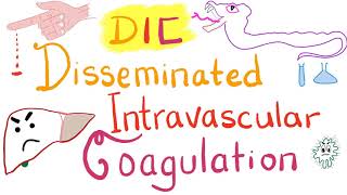 Disseminated Intravascular Coagulation DIC [upl. by Kanter]