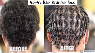 💋Learn how to  Starter Locs on 4b4c Hair [upl. by Doss]