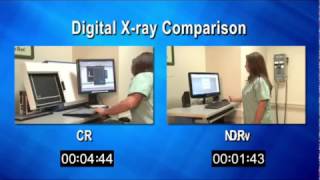 CR amp DR Comparison [upl. by Swerdna]