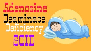 Adenosine Deaminase Deficiency  SCID  Lecture 8 [upl. by Giltzow]