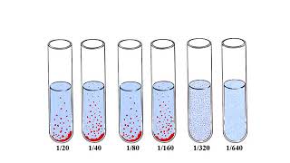 Widal test [upl. by Llereg]