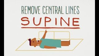 Remove Central Lines Supine [upl. by Bryce153]