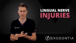 LINGUAL NERVE INJURIES IN DENTISTRY  OnlineExodontiacom [upl. by Shir296]