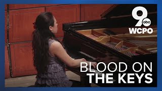 Bloody piano keys Pianist says it doesnt hurt actually [upl. by Gord]